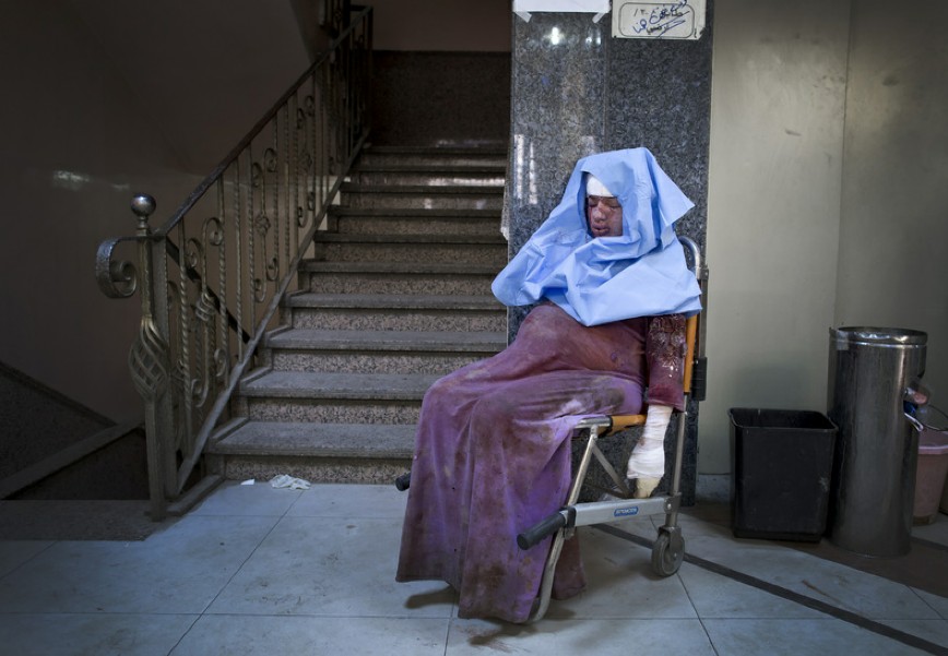 Una mujer herida estaba recibiendo el tratamiento en el Hospital Dar al Shifaa 一名重傷員在Dar al Shifaa醫(yī)院外等待醫(yī)護(hù)人員送她去政府軍控制的醫(yī)院接受救治。