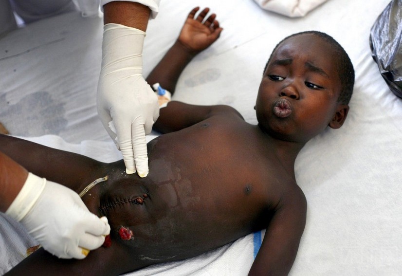 El día 26 de noviembre de 2012 en Goma, Gongo, la enfermera ayudó al niño Gloire Sebahunde sacar la bala, le dolía mucho.