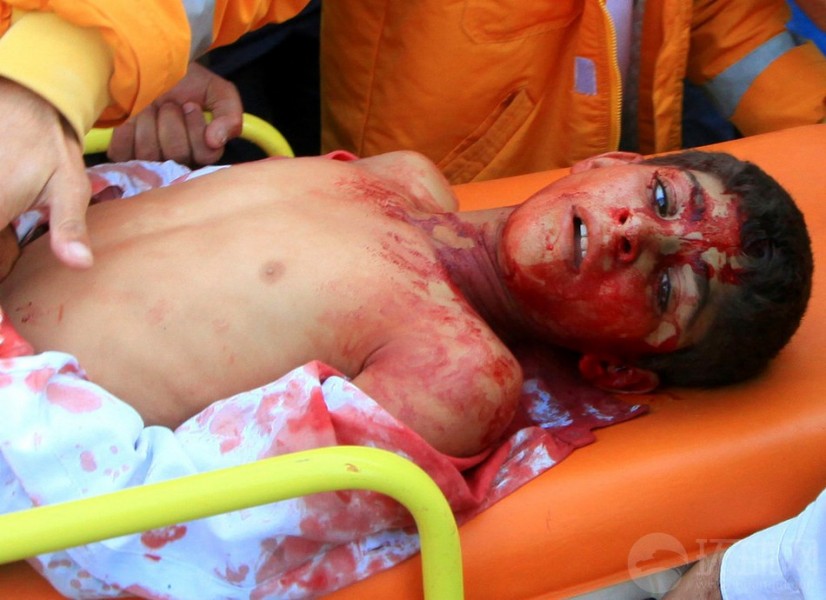 El día 12 de noviembre de 2012, la zona Ras al-Ain fue atacada por el avión sirio y dejaba muchos muertos y heridos.