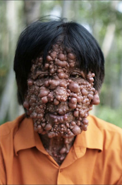 No.4 El 'hombre burbuja' anhela su primer beso