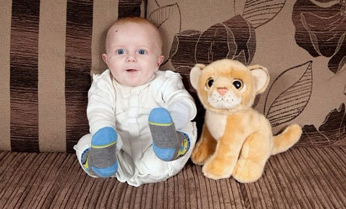 Epidermolysis bullosa