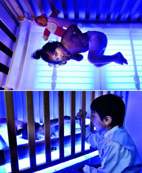 crigler-najjar syndrome