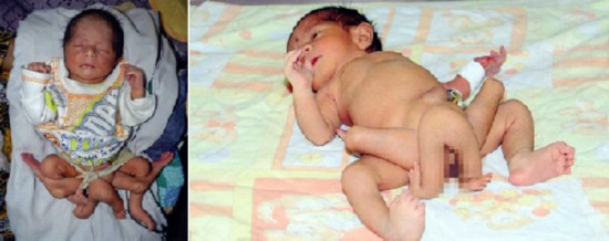 Las enfermedades curiosas