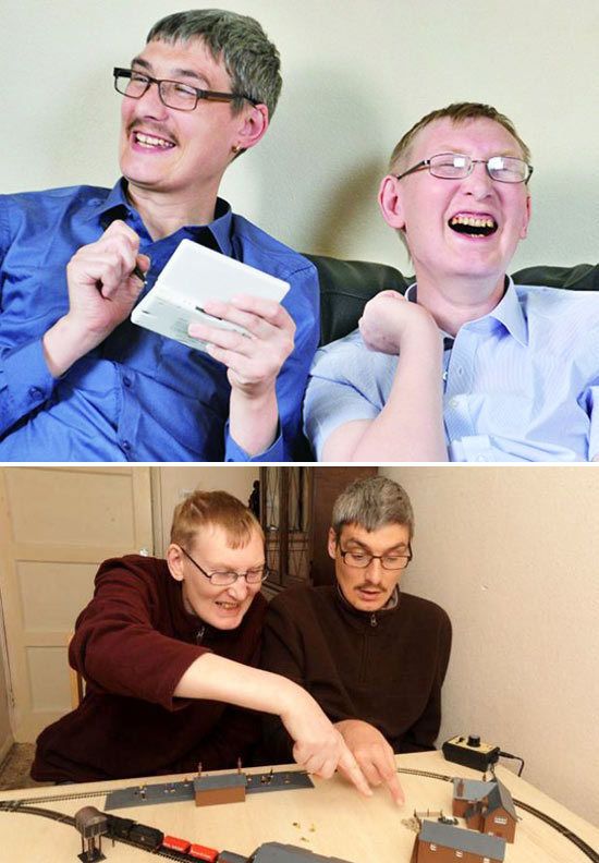 white matter diseases