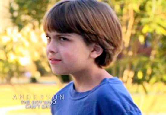 eosinophilic esophagitis