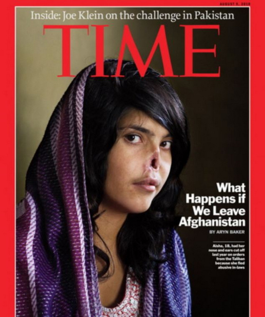 Aisha, la joven afgana que fue tapa de Time tendrá una nueva nariz