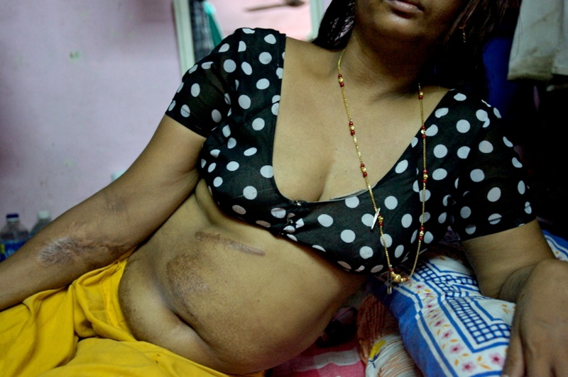 Fotografías documentales: la vida miserable de las prostitutas de India