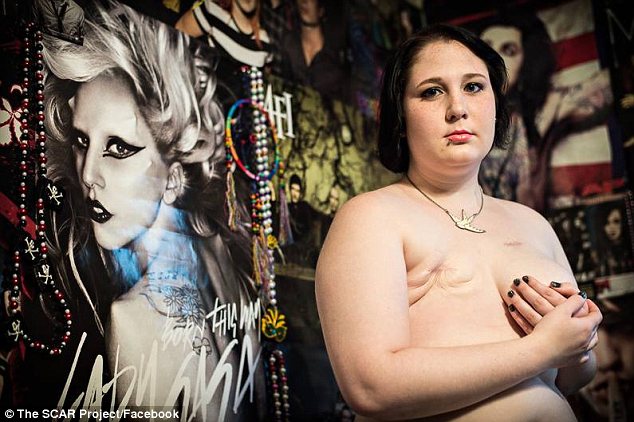 Fotos de las mujeres sin pechos en Facebook