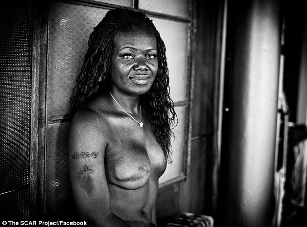 Fotos de las mujeres sin pechos en Facebook