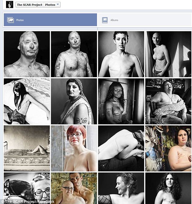 Fotos de las mujeres sin pechos en Facebook