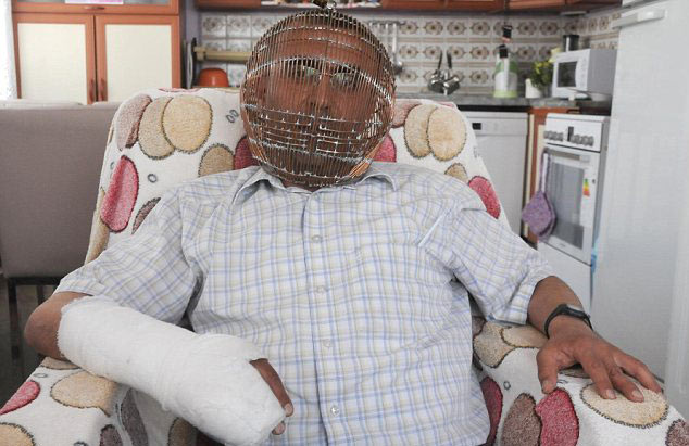 Un hombre turco inventa una jaula facial para dejar de fumar 1