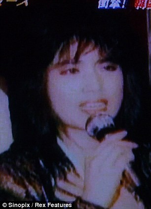 Modelo surcoreana quedó desfigurada por inyectar aceite en su rostro 3