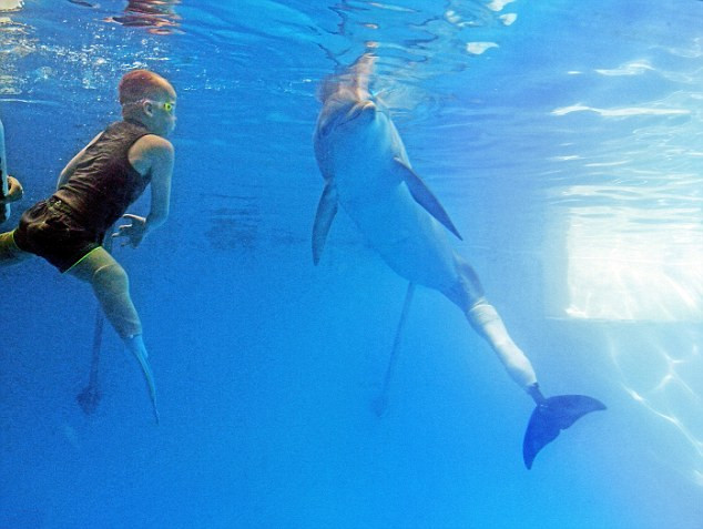 Niños de 8 años quien perdió las dos piernas nada con un delfin