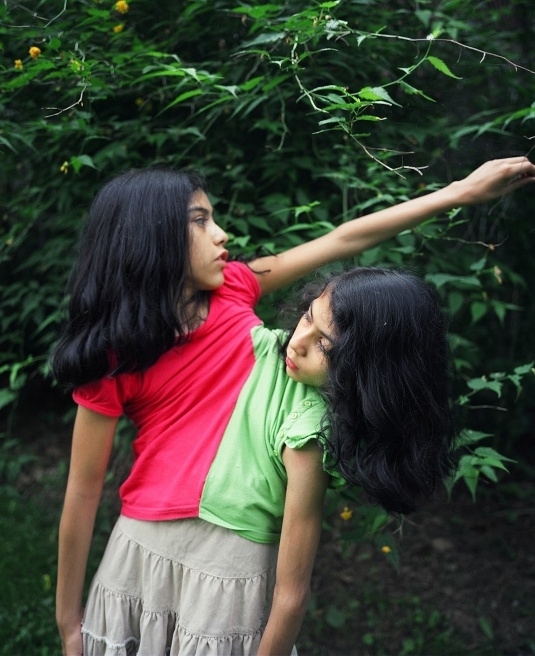 La vida feliz y verdadera de gemelas siamesas mexicanas