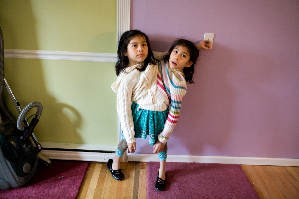 La vida feliz y verdadera de gemelas siamesas mexicanas