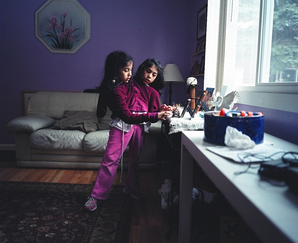 La vida feliz y verdadera de gemelas siamesas mexicanas