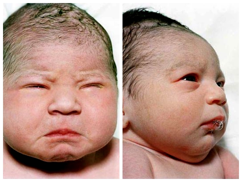 Las caras que dan los bebés recién nacidos1