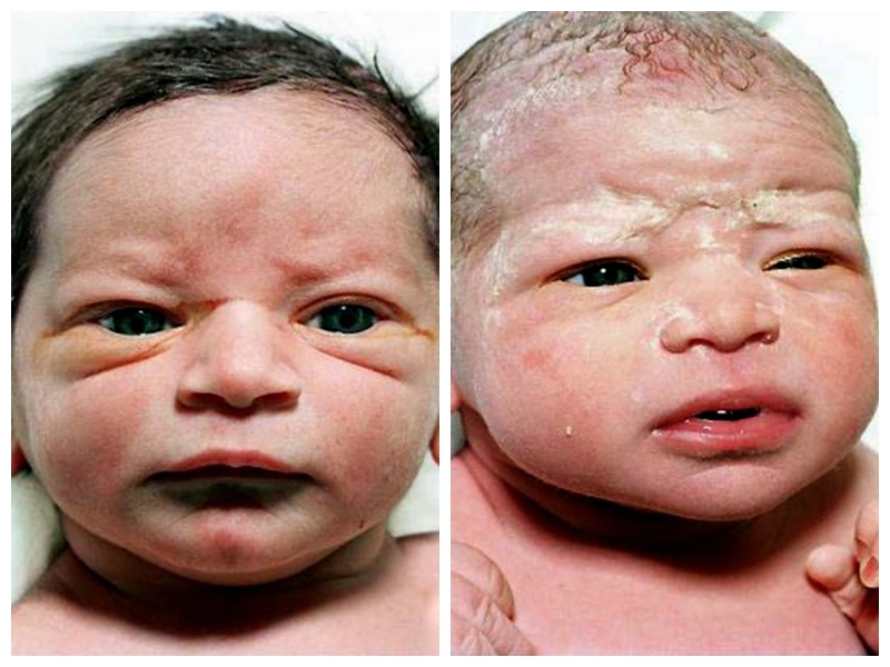 Las caras que dan los bebés recién nacidos2