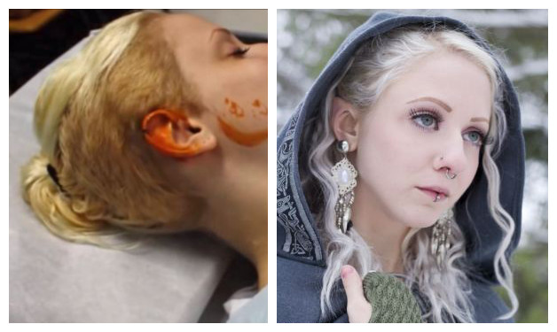 Mujer se operó las orejas para lucir como un elfo