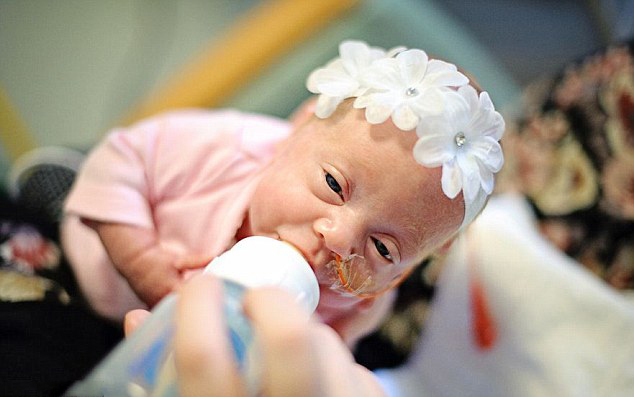 Fotos de bebés recién nacidos con fuertes ganas de superevivir10