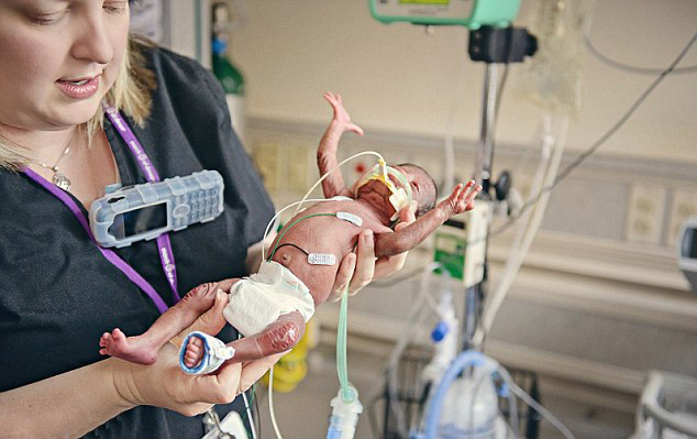 Fotos de bebés recién nacidos con fuertes ganas de superevivir9