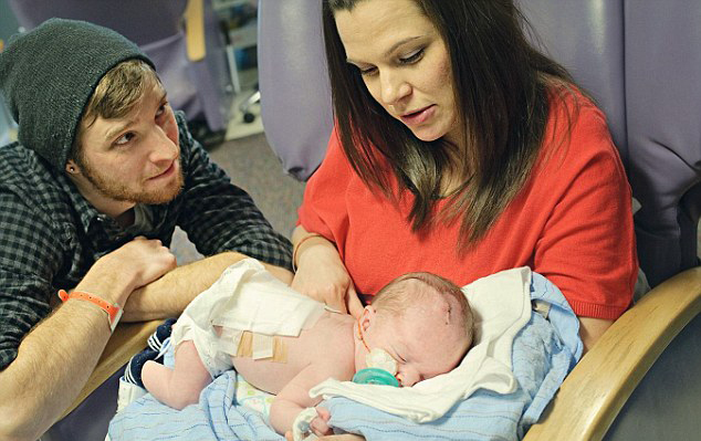 Fotos de bebés recién nacidos con fuertes ganas de superevivir3