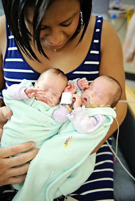 Fotos de bebés recién nacidos con fuertes ganas de superevivir2