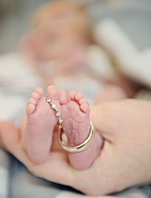 Fotos de bebés recién nacidos con fuertes ganas de superevivir1