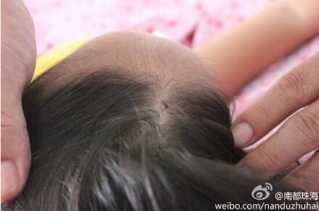 Niña estuvo a punto de morir a causa de misteriosa “aguja voladora” tóxica Niña estuvo a punto de morir a causa de misteriosa “aguja voladora” tóxica