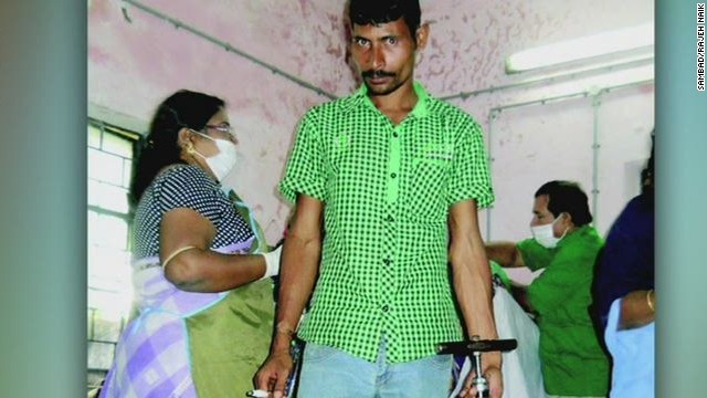 Médico utilizaba una bomba de bicicleta para esterilizar mujeres en la India
