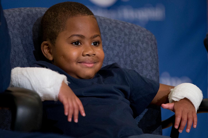 Se realiza un trasplante de manos a un niño de ocho años1