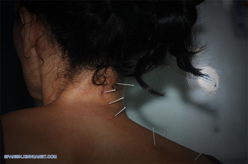 Tratamiento de acupuntura de China