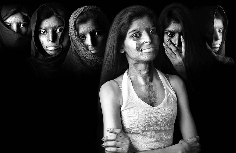 Impresionantes fotografías documentales reflejan la vida de las víctimas del ácido sulfúrico8