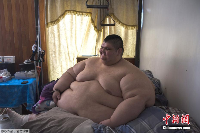 Chico mexicano logra perder 170 kilos en cuatro meses5