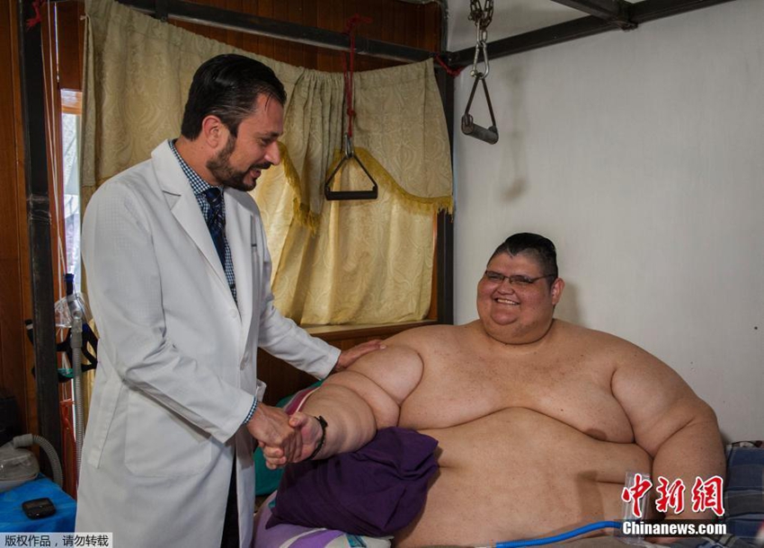 Chico mexicano logra perder 170 kilos en cuatro meses3