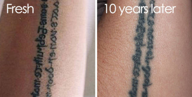 No existen tatuajes permanentes