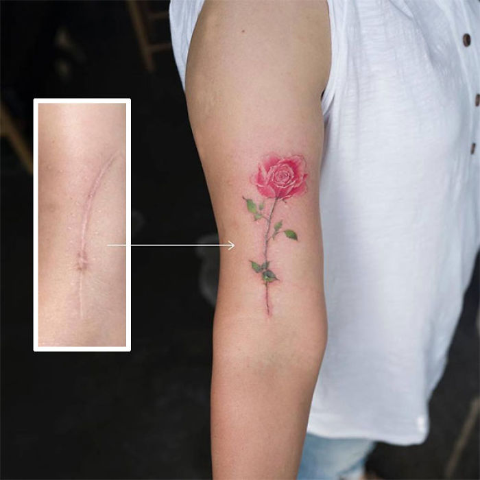 Tatuajes geniales que convierten cicatrices en obras de arte