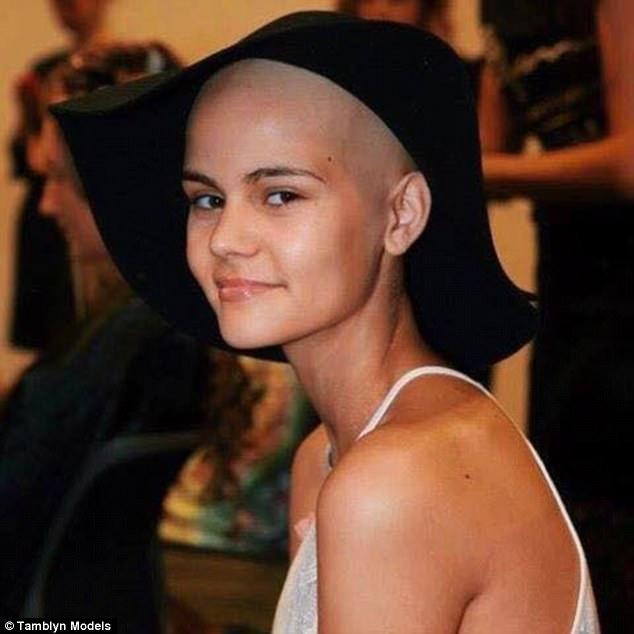 Venessa Harris, la chica que padece de cancer no deja de lucharse por su sueño de ser modelo4