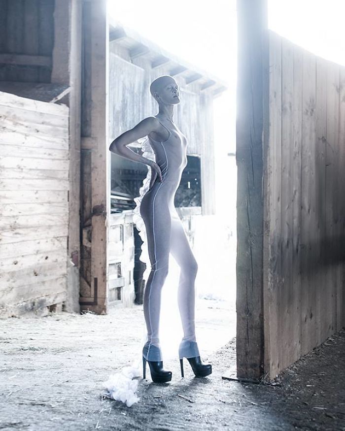 Melanie Gaydos, modelo de 28 años con un trastorno genético raro que rompió todos los estereotipos de moda