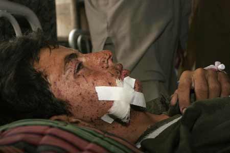 A wounded tribesman belonging to the Mohmand tribal agency which borders with Afghanistan, is treated in a hospital in Peshawar June 11, 2008. 