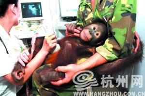 The orangutan will undergo a type-B ultrasonic test at the hospital. [hangzhou.com.cn] 