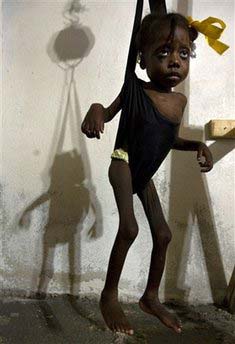 Venecia Lonis, 4, who suffers from malnutrition, is weighed at the Doctors Without Borders hospital in Port-au-Prince, Wednesday, November 19, 2008.