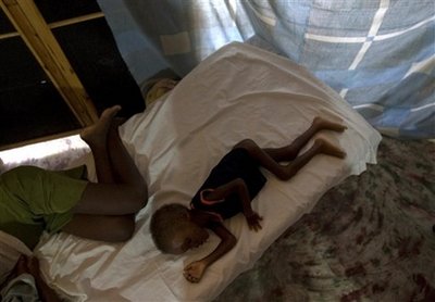Pierre Davidson, 3, who suffers from malnutrition, lies on a bed at the Doctors Without Borders hospital in Port-au-Prince, Wednesday, Nov. 19, 2008. Aid workers fear hunger is worsening in rural Haiti after at least 26 children died of conditions exacerbated by a lack of nutrition, raising concerns that a grave food crisis may be brewing following four devastating tropical storms. 