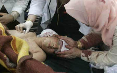 A child who was wounded in a bomb attack receives treatment in a hospital in Kirkuk, 250 km (155 miles) north of Baghdad December 11, 2008. The death toll from suicide bomb attack at a restaurant in Kirkuk on Thursday rose to 47 and some 93 others injured, a local police source said. [Xinhua/Reuters]