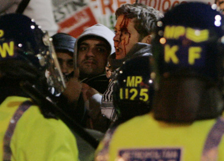 A pro-Palestinian demonstrator bleeds during a protest in response to the Israeli air strikes on Gaza near the Israeli Embassy in London January 3, 2009. 