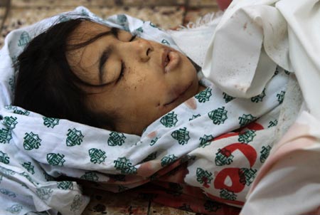 The body of a 12-year-old Palestinian girl killed during Israeli military operations in Tal al Hawa area lies at a mortuary in Gaza City, Jan. 16, 2009. The death toll in Gaza has risen to more than 1140 since the beginning of the Israeli massive attack on Gaza on Dec. 27, 2008, with about 5150 wounded, Gaza emergency chief Mo'aweya Hassanein said on Friday. (Xinhua/Wissam Nassar)