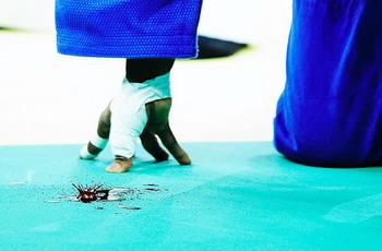 This photo shoot by Xiaoling Wu from China's Xinhua News Agency takes first prize in the Sports Features singles category with his color image of an injured judoka at the Beijing Olympic Games in August last year.[Xinhua]