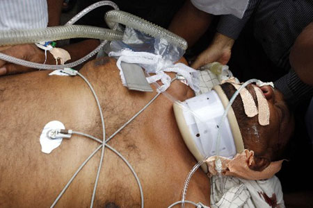 Medical staff rush Sri Lankan Post and Telecommunication Minister Mahinda Wijesekara to a hospital in Colombo after he was injured by a suspected Tamil Tiger suicide attack in Mathara, south Sri Lanka, March 10, 2009. 