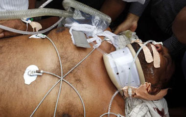 Medical staff rush Sri Lankan Post and Telecommunication Minister Mahinda Wijesekara to a hospital in Colombo after he was injured by a suspected Tamil Tiger suicide attack in Mathara, south Sri Lanka, March 10, 2009.