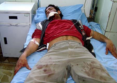 A wounded Iraqi rests on a bed at the Al-Yarmuk hospital in Baghdad. Iraqi tribal leaders and army officers were among the 33 people killed by a suicide bomber outside the town hall in Abu Ghraib.